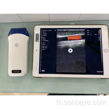 appareils à ultrasons de poche sans fil